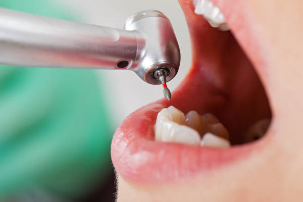 Best Emergency Dental Care for Broken or Chipped Teeth in Elsmere, KY